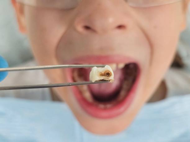 Best Emergency Treatment for Toothache in Midlothian, TX